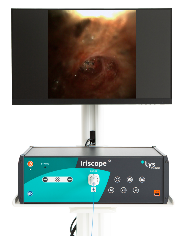 Iriscope Controller and monitor