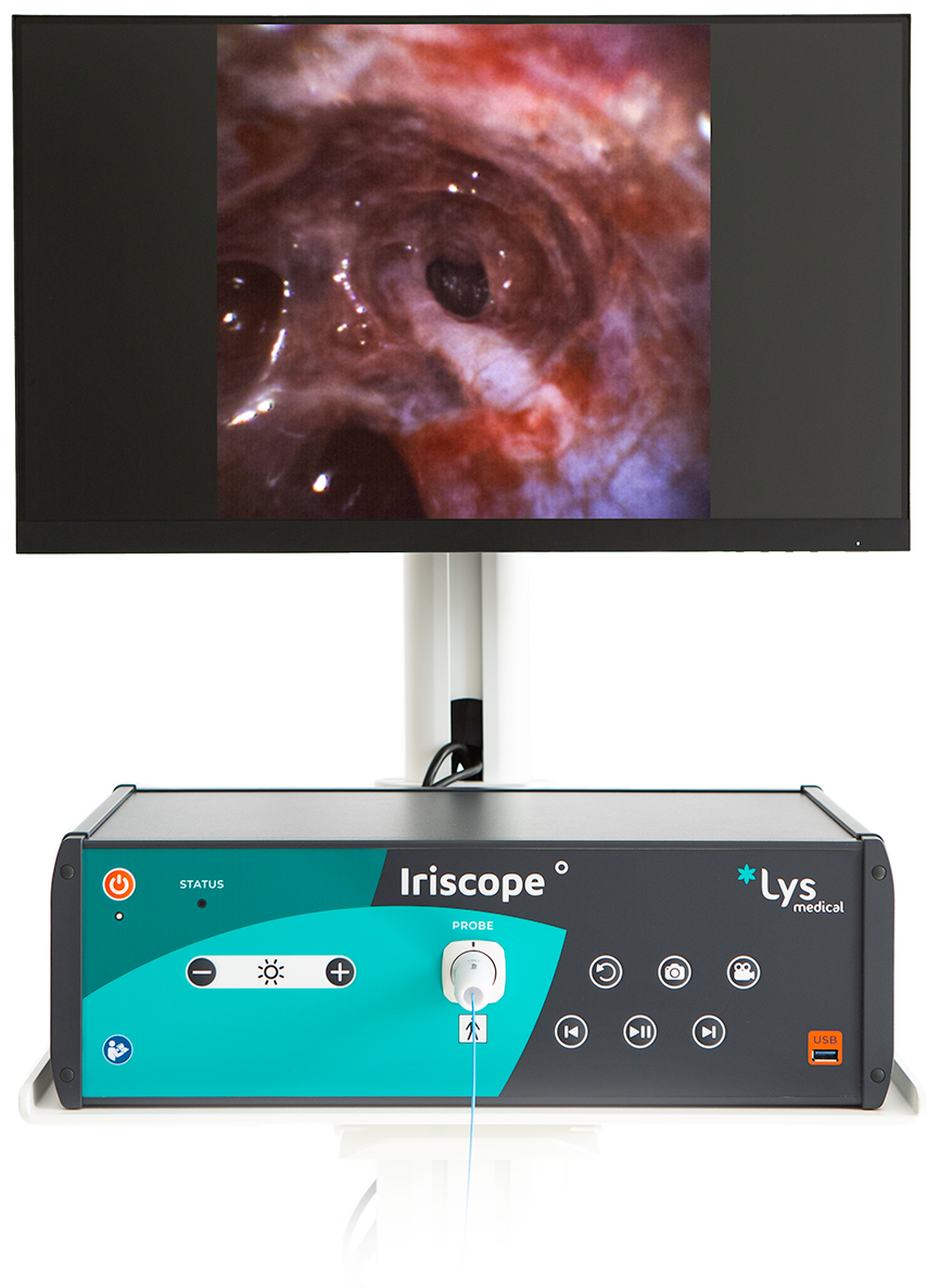 Iriscope controller and monitor